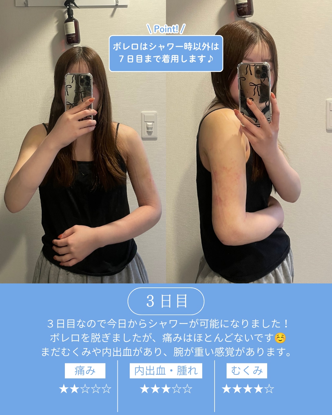 術後3日目