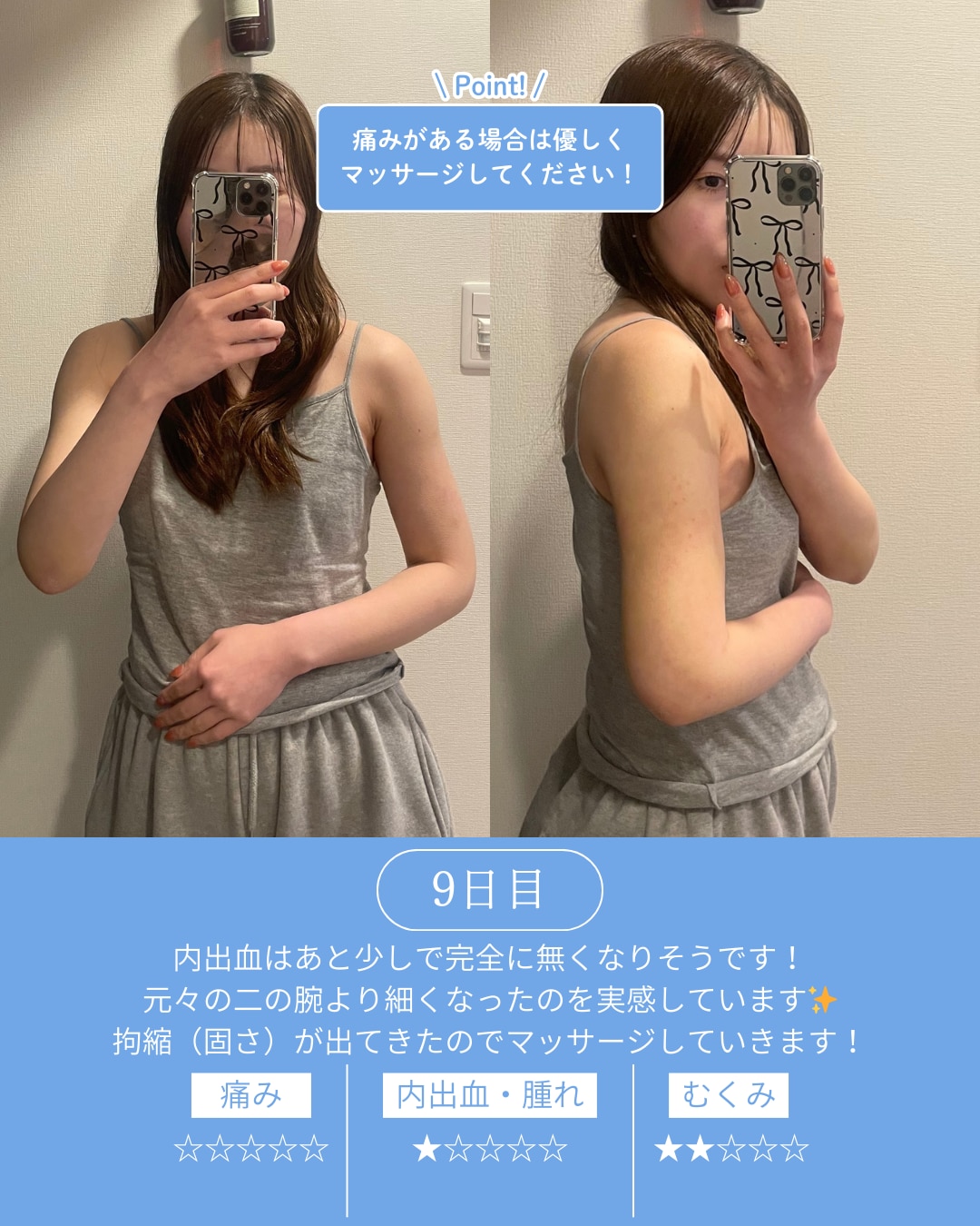 術後9日目