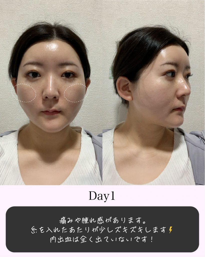 症例写真2