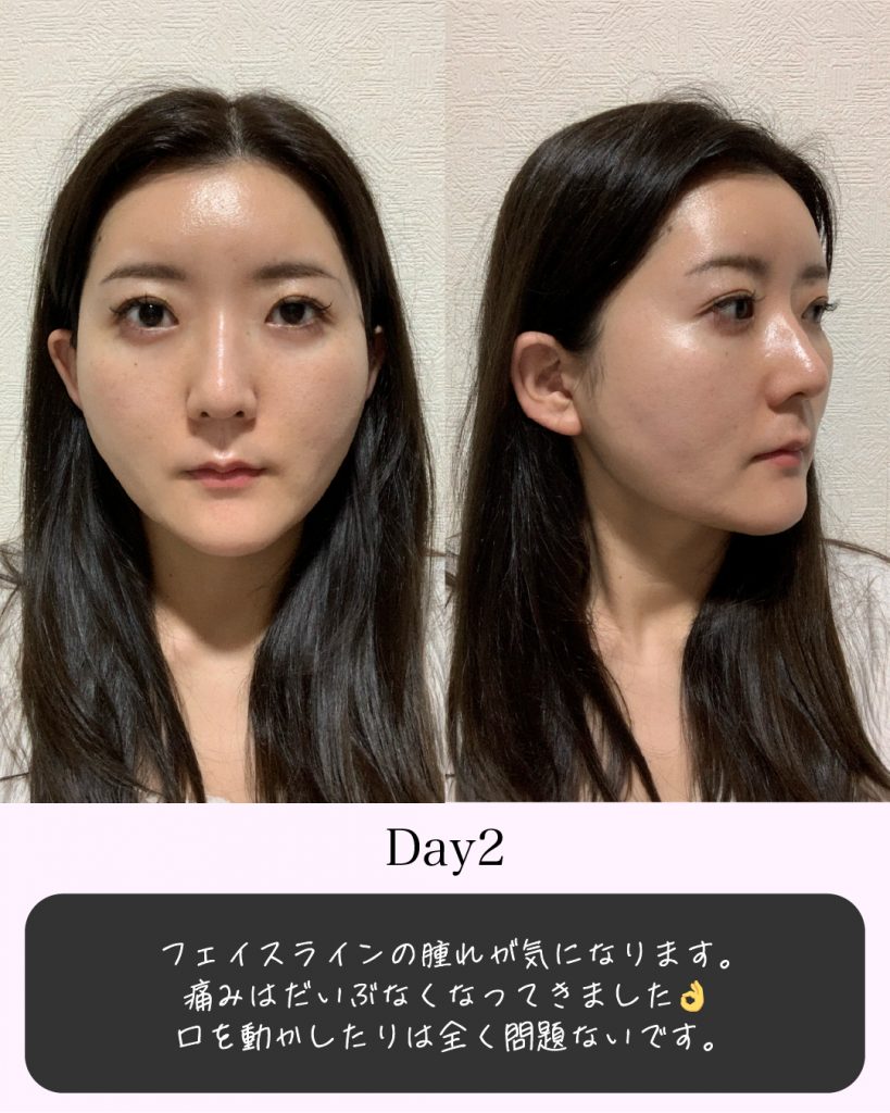 症例写真3