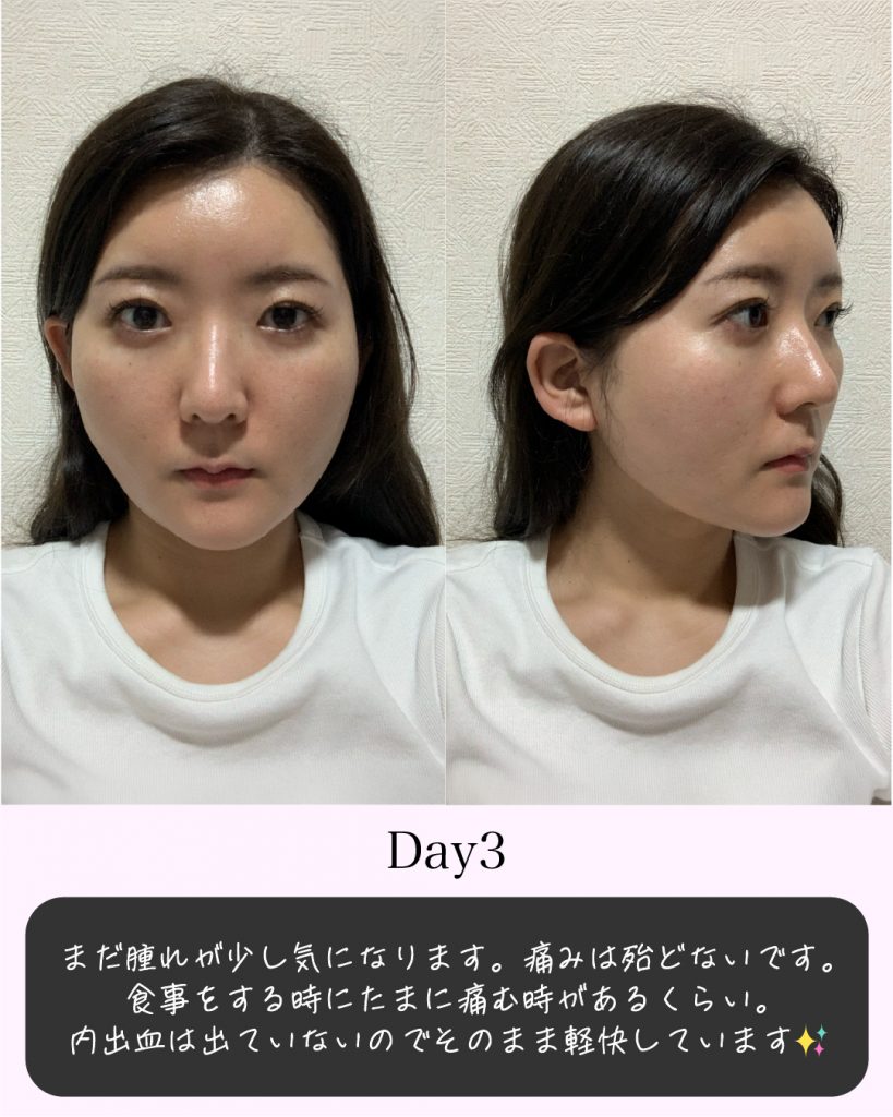 症例写真4