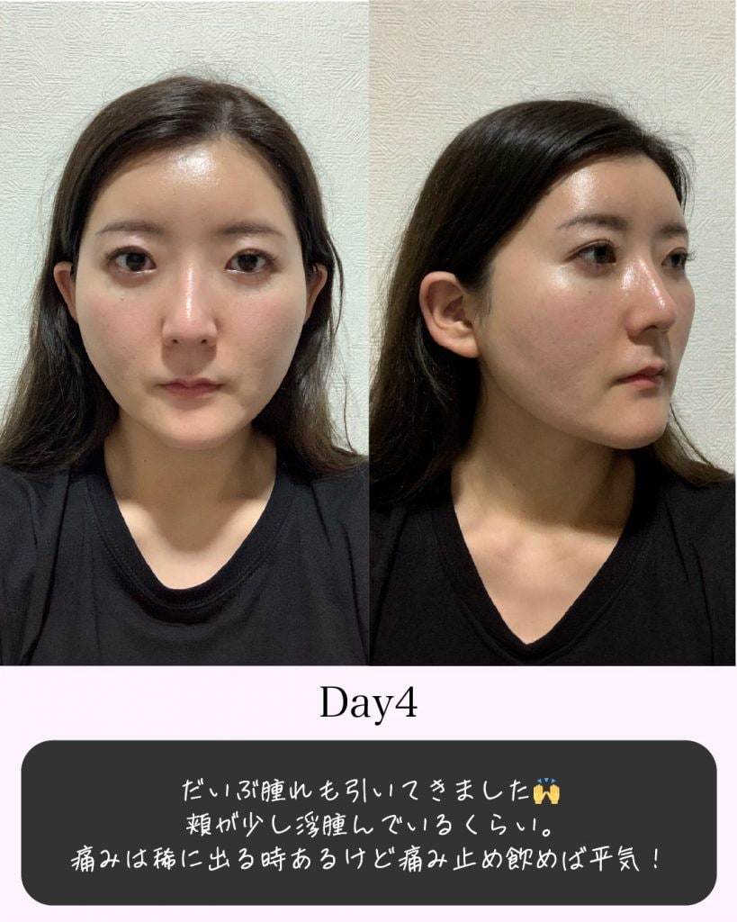 症例写真5