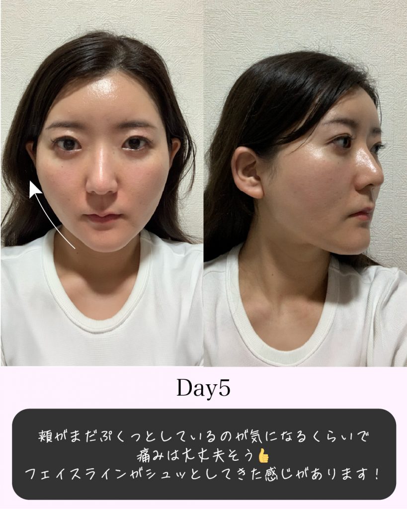 症例写真6