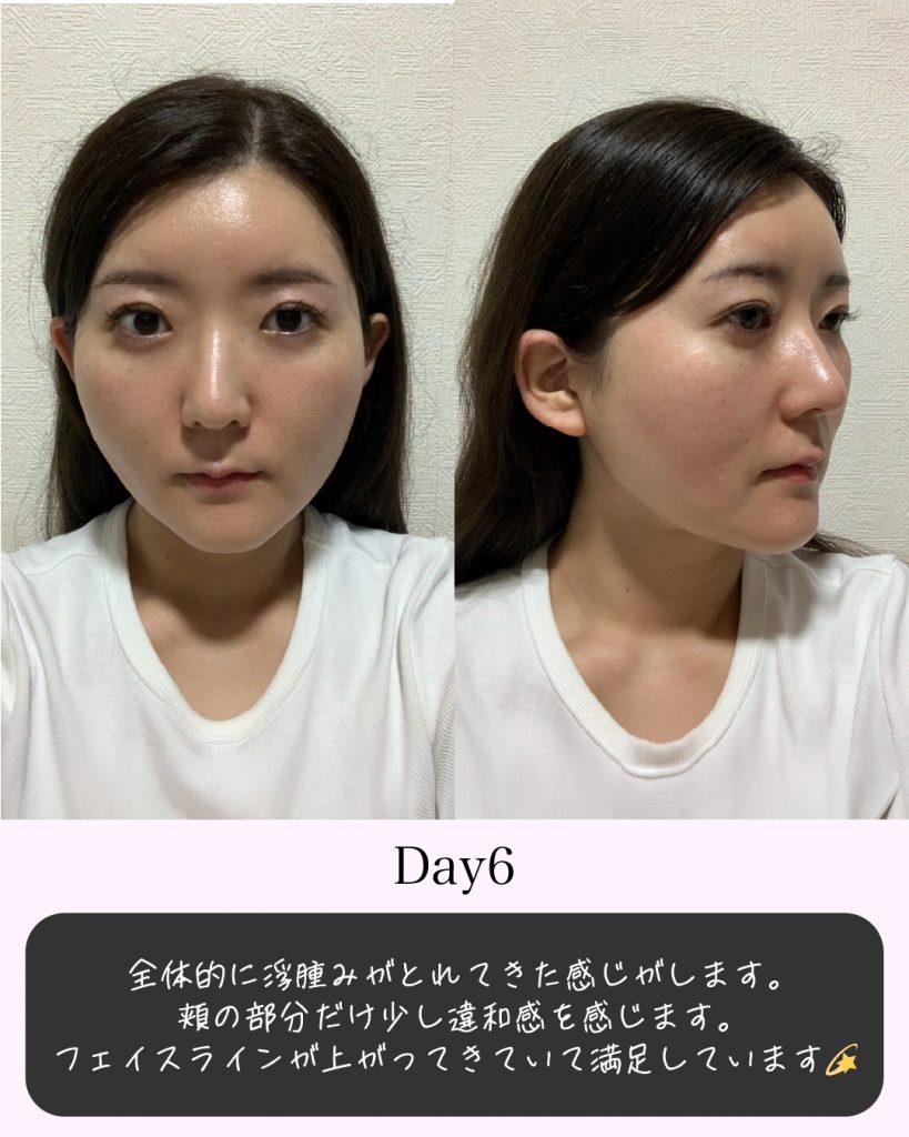 症例写真7
