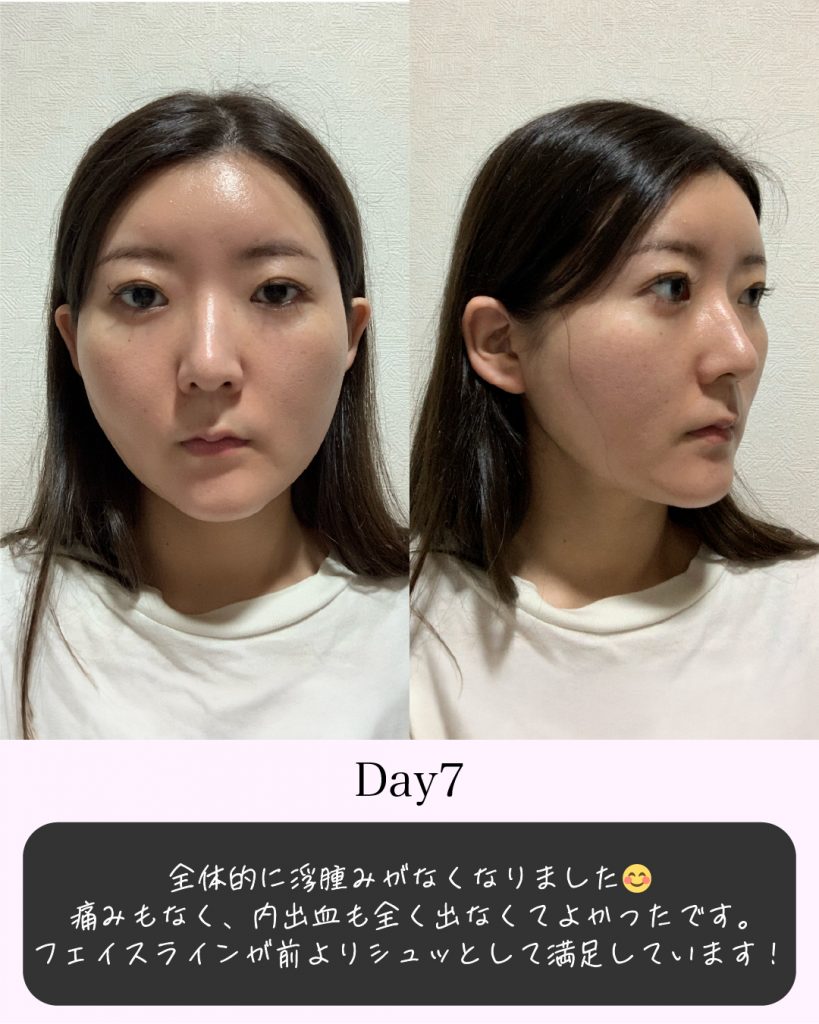 症例写真8