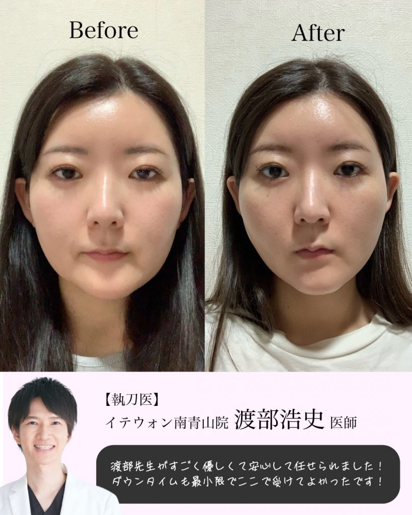 症例写真9