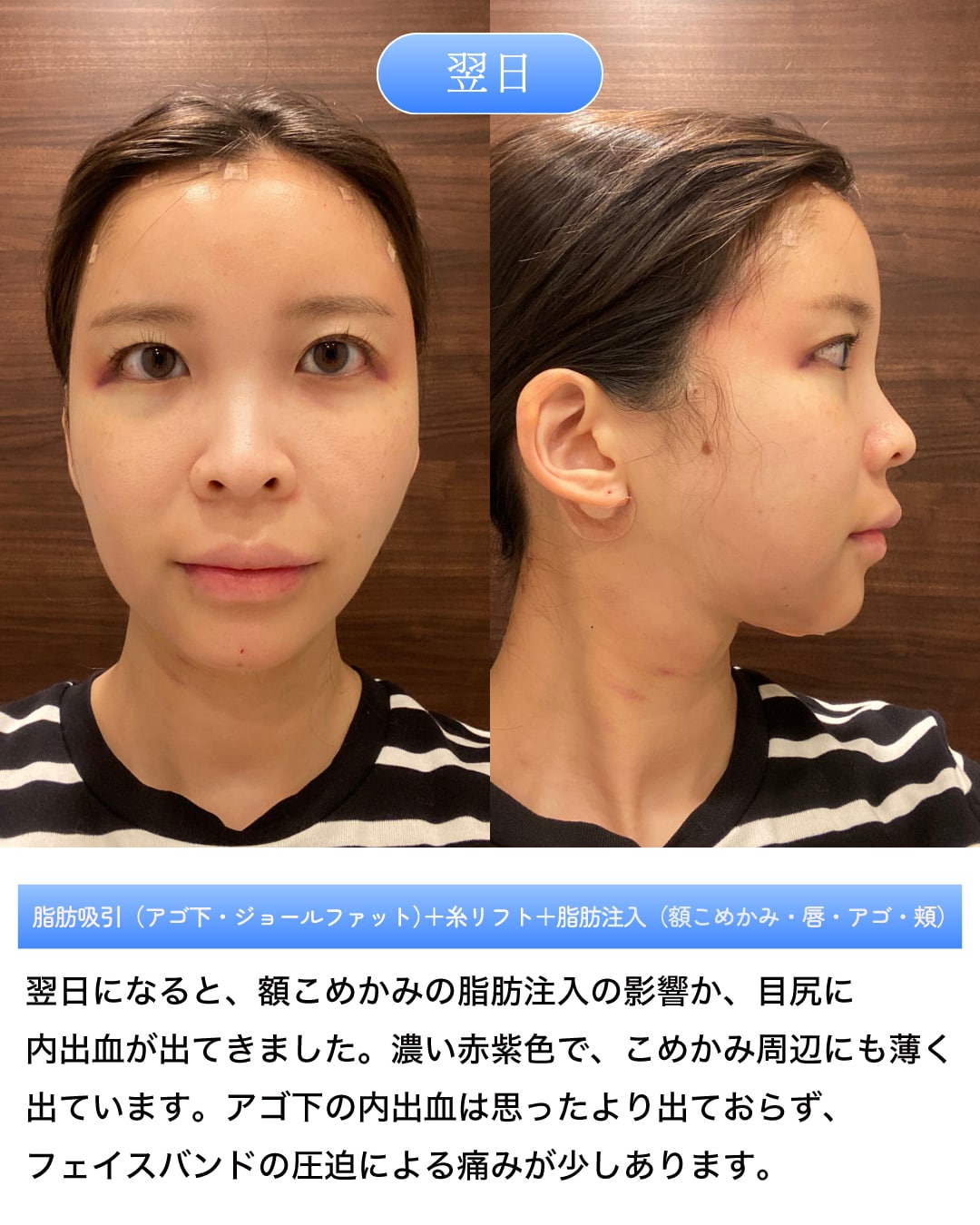 翌日