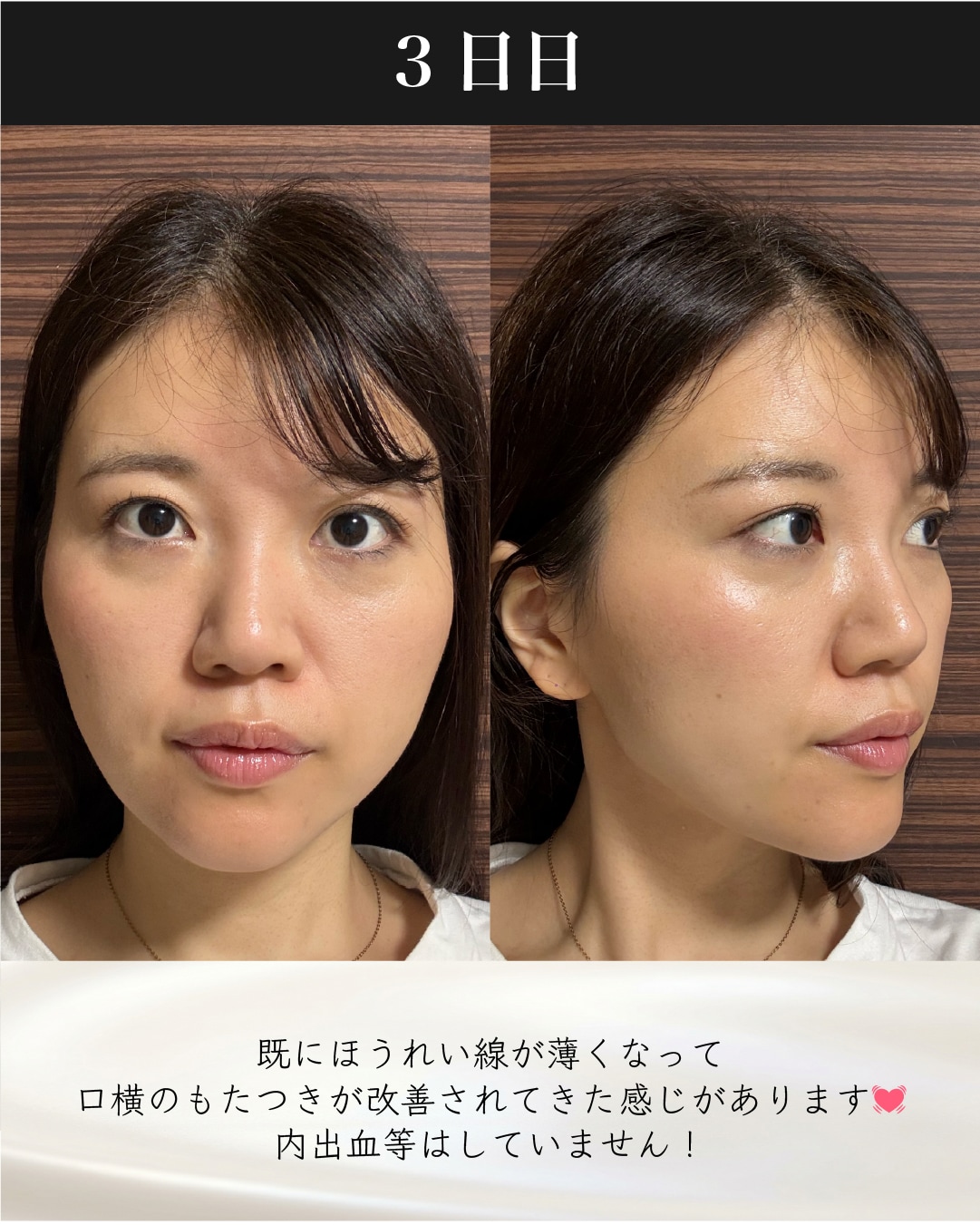 症例6