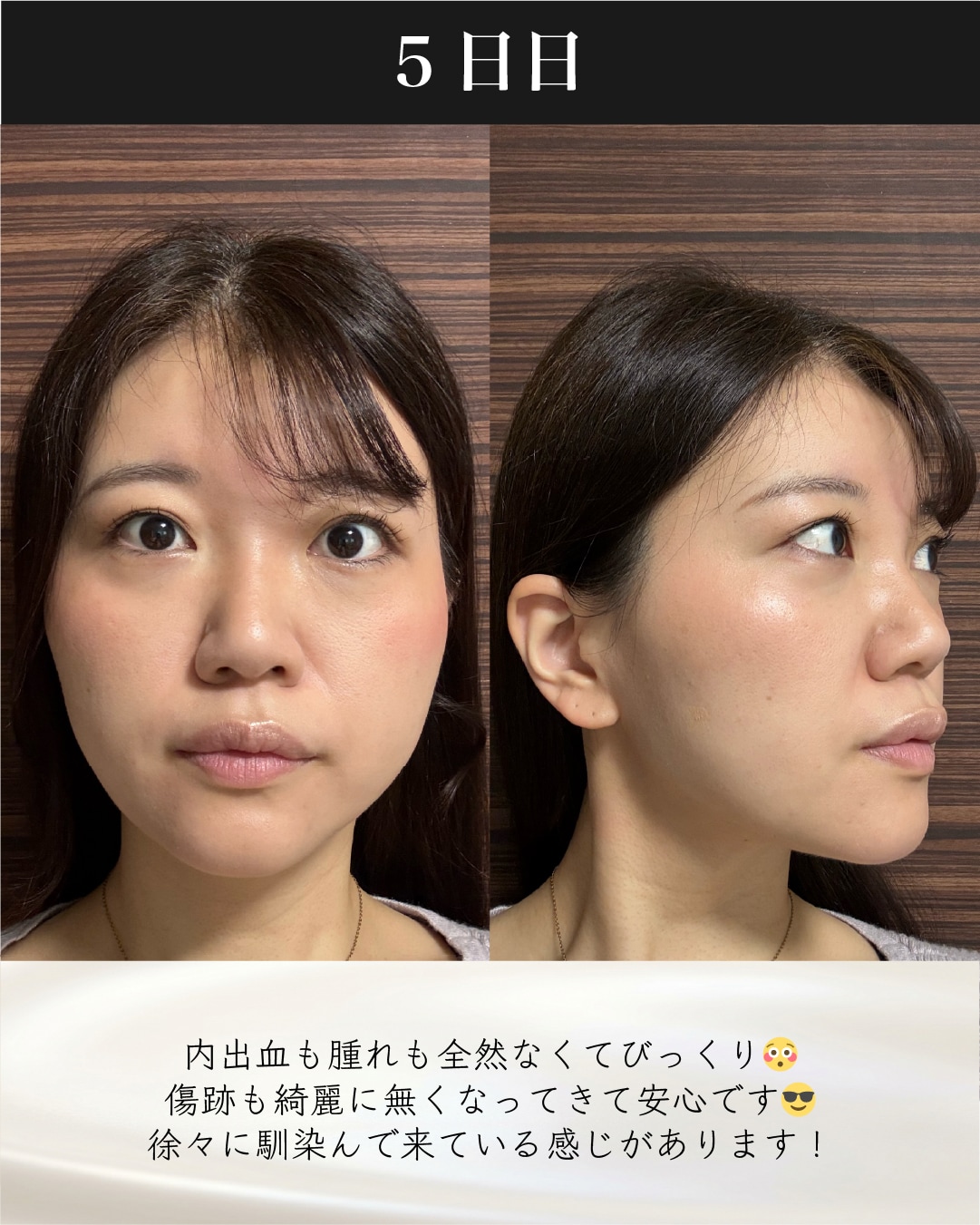 症例8