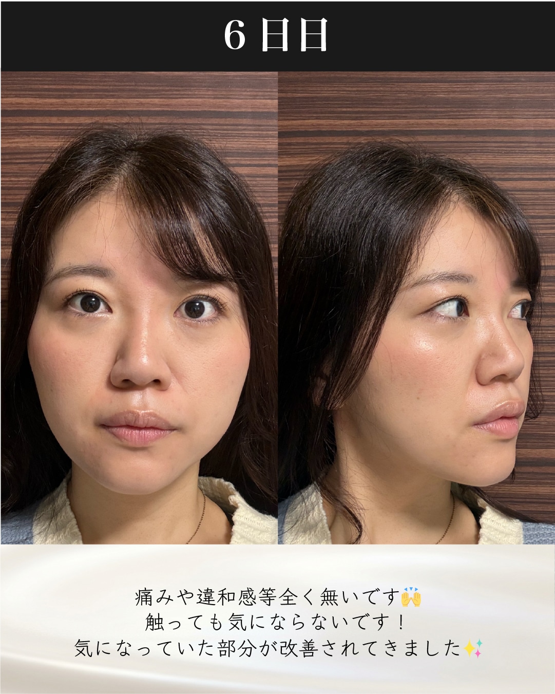 症例9