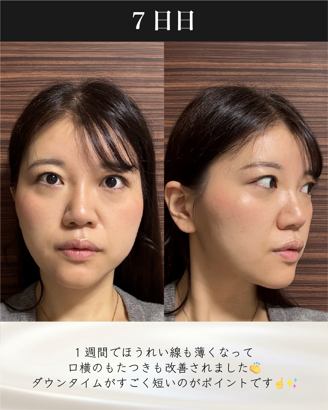 症例10