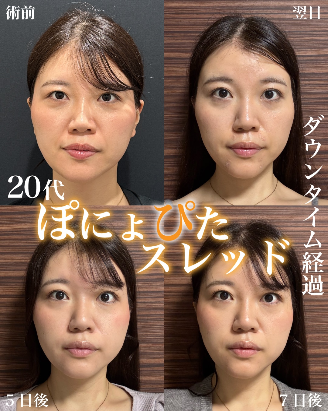 症例1