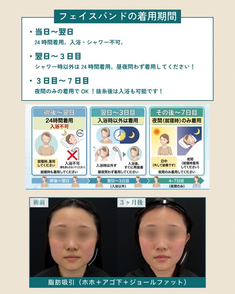 フェイスバンドの着用期間
