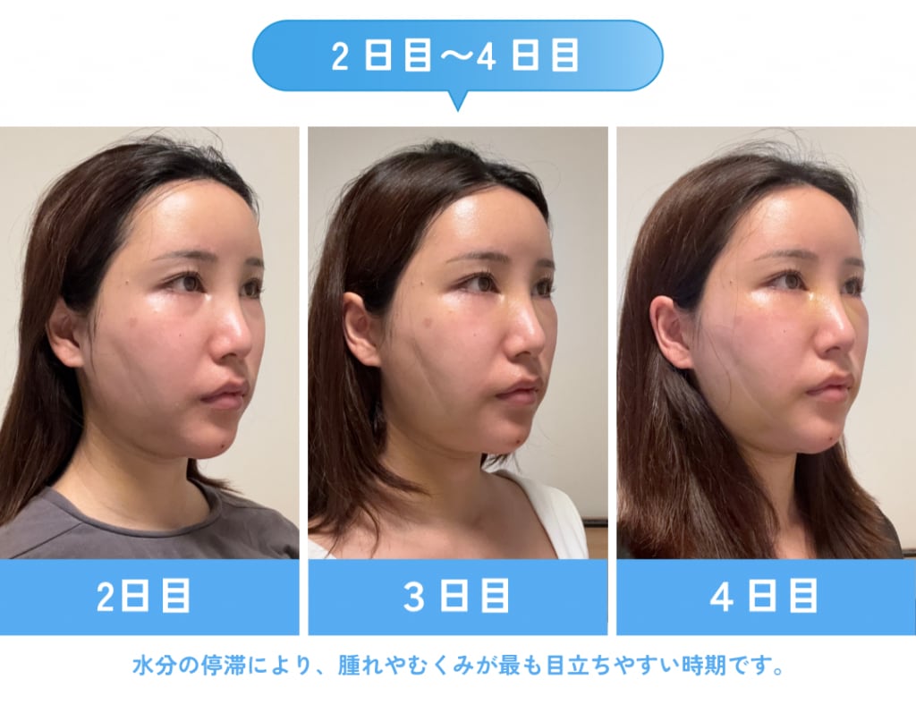 2日目〜4日目