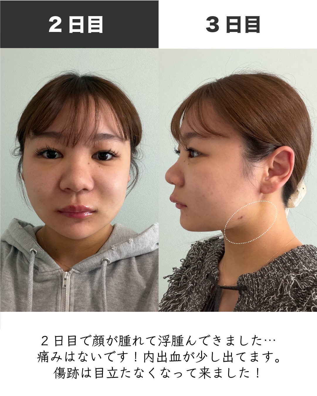 症例写真3