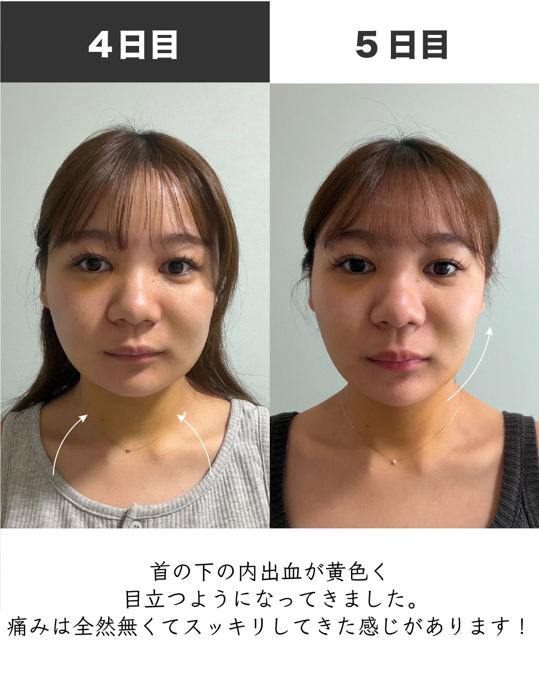 症例写真4