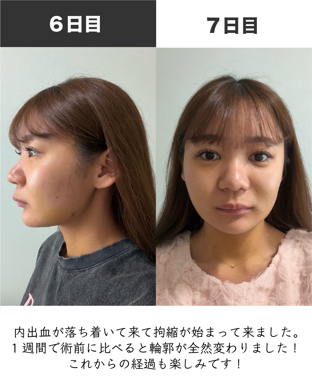症例写真5