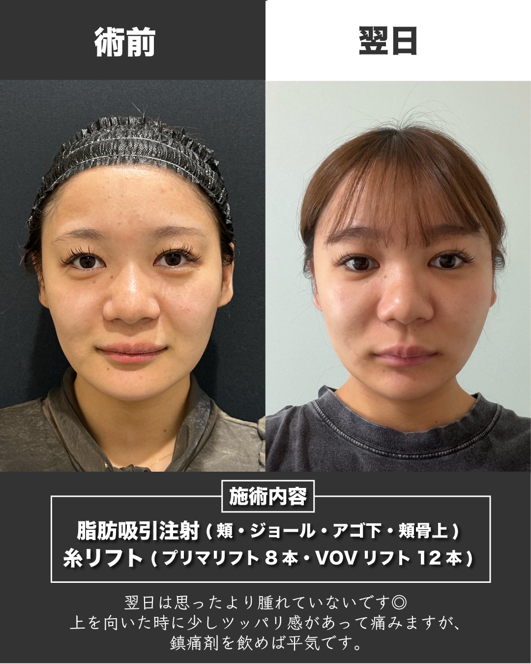 症例写真2