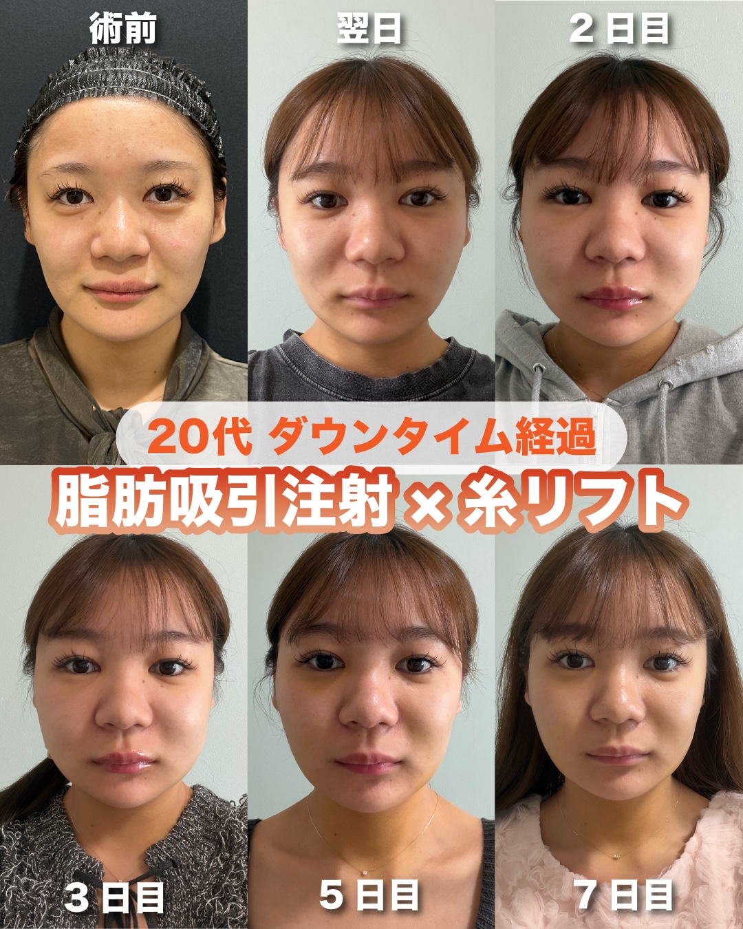 症例写真1