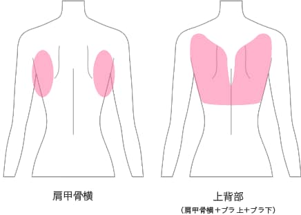 部位