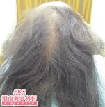 症例写真