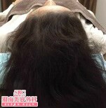 症例写真