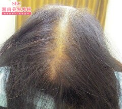 症例写真