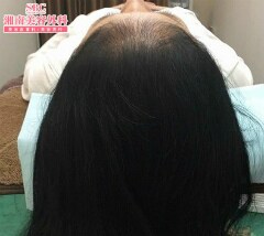 症例写真