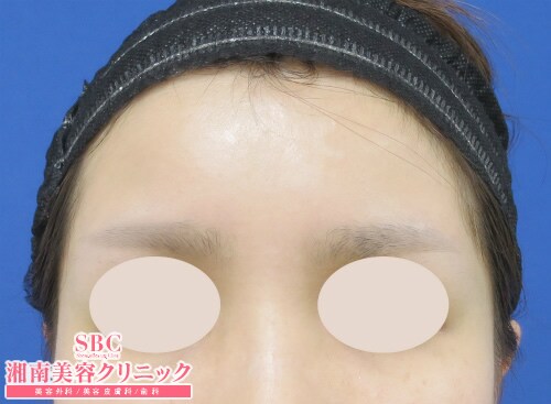 症例写真 脇田理恵 若返り 湘南美容クリニック 症例写真 脇田理恵 若返り 湘南美容クリニック