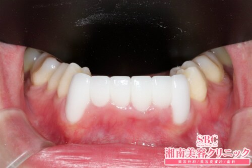 症例写真 美容歯科 湘南美容クリニック