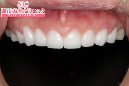 症例写真 美容歯科 湘南美容クリニック