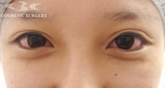 症例写真, 症例写真