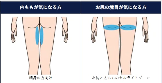 太ももスタンダードプラン