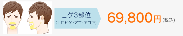 脱毛までの4STEP!