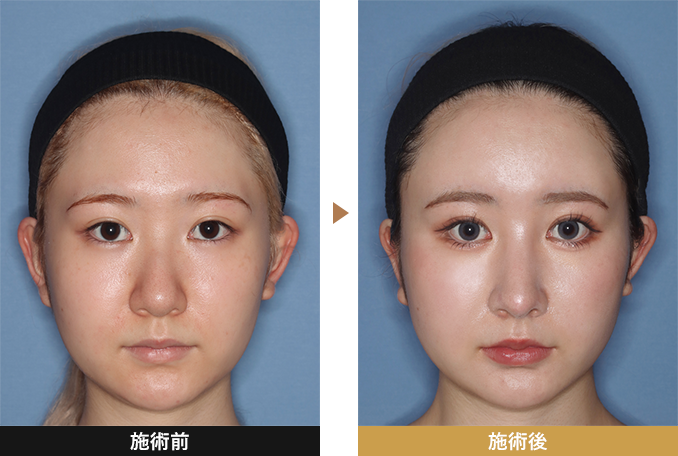 佐藤医師の施術写真