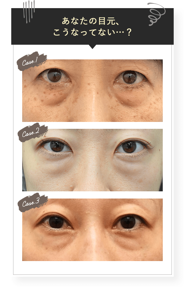 あなたの目元、こうなってない…?