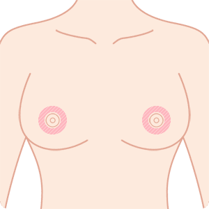 乳輪周囲