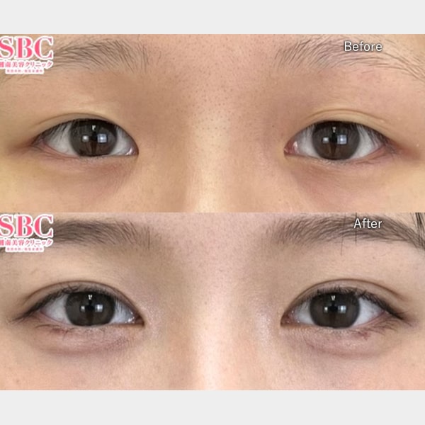 足立 紫音医師 症例写真