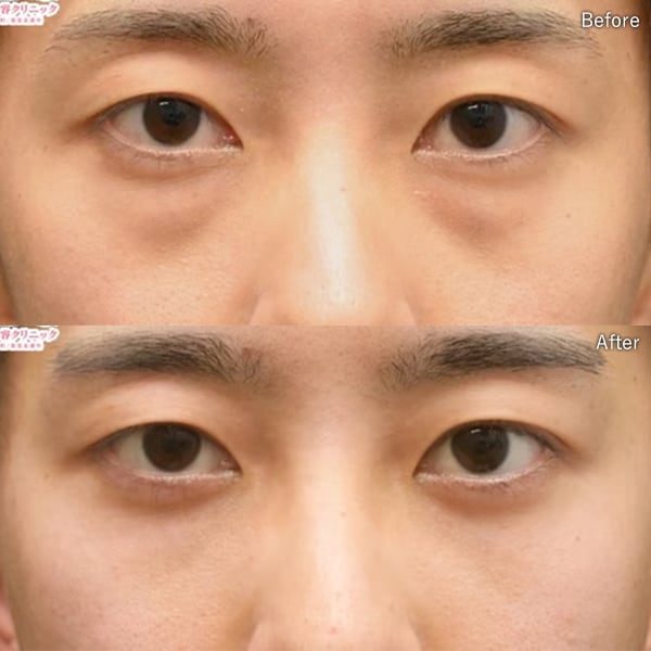 上田 将士医師 症例写真