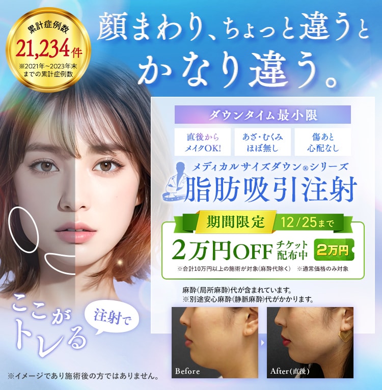 小顔用脂肪吸引注射